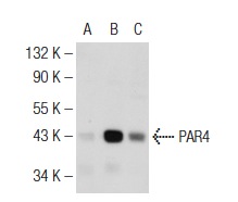 PAR4 (C-19): sc-1249. Western blot analysis of PAR4 expression in non-transfected 293: sc-110760 (A), mouse PAR4 transfected 293: sc-179292 (B) and NIH/3T3 (C) whole cell lysates.