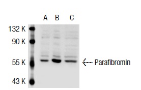 Parafibromin (H-300): sc-48770. Western blot analysis of Parafibromin expression in non-transfected 293T: sc-117752 (A), human Parafibromin transfected 293T: sc-117050 (B) and HeLa (C) whole cell lysates.