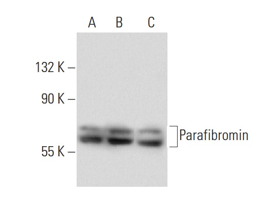 Parafibromin (H-300): sc-48770. Western blot analysis of Parafibromin expression in non-transfected 293T: sc-117752 (A), human Parafibromin transfected 293T: sc-177703 (B) and C32 (C) whole cell lysates.