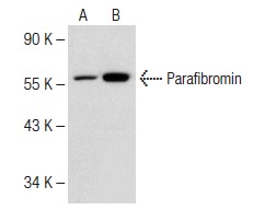 Parafibromin (E-4): sc-373792. Western blot analysis of Parafibromin expression in non-transfected: sc-117752 (A) and human Parafibromin transfected: sc-117050 (B) whole cell lysates.