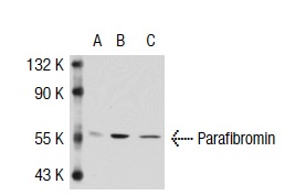 Parafibromin (2H1): sc-33638. Western blot analysis of Parafibromin expression in non-transfected 293T: sc-117752 (A), human Parafibromin transfected 293T: sc-117050 (B) and HeLa (C) whole cell lysates.
