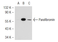 Parafibromin (2H1): sc-33638. Western blot analysis of Parafibromin expression in non-transfected 293T: sc-117752 (A), mouse Parafibromin transfected 293T: sc-122375 (B) and C32 (C) whole cell lysates.