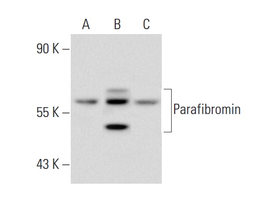 Parafibromin (2H1): sc-33638. Western blot analysis of Parafibromin expression in non-transfected 293T: sc-117752 (A), human Parafibromin transfected 293T: sc-177703 (B) and C32 (C) whole cell lysates.