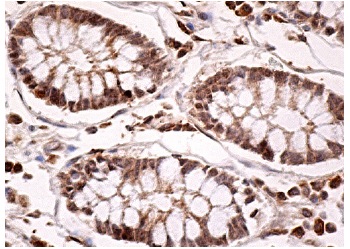 Parafibromin (2H1): sc-33638. Immunoperoxidase staining of formalin fixed, paraffin-embedded human colon tissue showing nuclear staining of glandular cells.