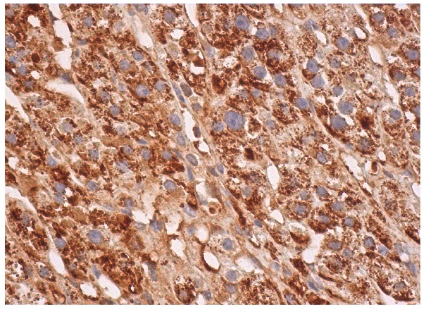 Pirh2 (FL-261): sc-67033. Immunoperoxidase staining of formalin fixed, paraffin-embedded human adrenal gland tissue showing cytoplasmic staining of glandular cells.