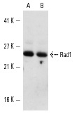 Rad1 (Q-18): sc-14316. Western blot analysis of Rad1 expression in non-transfected: sc-110760 (A) and human Rad1 transfected: sc-110519 (B) 293 whole cell lysates.