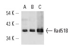 Rad51B (1H3/13): sc-53430. Western blot analysis of Rad51B expression in MOLT-4 (A), HeLa (B) and IMR-32 (C) nuclear extracts.