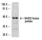 RAIDD (FL-199): sc-7880. Western blot analysis of human recombinant RAIDD fusion protein.