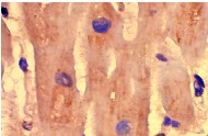 RAIDD (FL-199): sc-7880. Immunoperoxidase staining of formalin fixed, paraffin-embedded human heart tissue showing cytoplasmic localization.