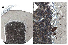 RAIDD (FL-199): sc-7880. Immunoperoxidase staining of formalin fixed, paraffin-embedded human cerebellum tissue showing cytoplasmic staining of cells in granular and molecular layers and Purkinje cells at low (A) and high (B) magnification. Kindly provided by The Swedish Human Protein Atlas (HPA) program.