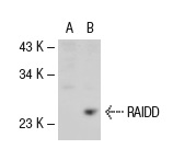 RAIDD (FL-199): sc-7880. Western blot analysis of RAIDD expression in non-transfected: sc-117752 (A) and mouse RAIDD transfected: sc-122950 (B) 293T whole cell lysates.