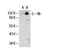 Rb (C-15): sc-50. Western blot analysis of Rb expression in non-transfected 293T: sc-117752 (A) and human Rb transfected 293T: sc-114014 (B) 29.3T whole cell lysates.