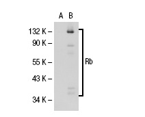Rb (C-15): sc-50. Western blot analysis of Rb expression in non-transfected: sc-117752 (A) and human Rb transfected: sc-114014 (B) 293T whole cell lysates.