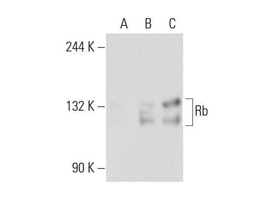 Rb (C-15): sc-50. Western blot analysis of Rb expression in non-transfected 293T: sc-117752 (A), human Rb transfected 293T: sc-159907 (B) and K-562 (C) whole cell lysates.