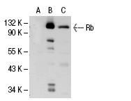 Rb (M-153): sc-7905. Western blot analysis of Rb expression in non-transfected: sc-117752 (A) and human Rb transfected: sc-114014 (B) 293T whole cell lysates.