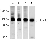 Western blot analysis of Rb p110 expression in A-431 whole cell lysate (A-C) and nuclear extract (D). Antibodies tested include Rb (C-15): sc-50 (A), Rb (C-15)-G: sc-50-G (B), Rb (IF8): sc-102 (C) and Rb (M-153): sc-7905 (D).