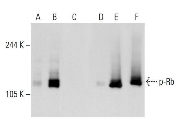 Western blot analysis of Rb phosphorylation in non-transfected: sc-117752 (A,D), untreated human Rb transfected: sc-114014 (B,E) and lambda protein phosphatase treated human Rb transfected: sc-114014 (C,F) 293T whole cell lysates. Antibodies tested include p-Rb (Ser 780)-R: sc-12901-R (A,B,C) and Rb (M-153): sc-7905 (D,E,F).