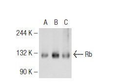 Rb (M-153): sc-7905. Western blot analysis of Rb expression in non-transfected 293T: sc-117752 (A), human Rb transfected 293T: sc-159907 (B) and K-562 (C) whole cell lysates.