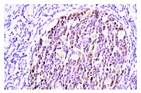 Rb (M-153): sc-7905. Immunoperoxidase staining of formalin-fixed, paraffin-embedded human tonsil tissue showing nuclear localization.
