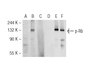 Western blot analysis of Rb phosphorylation in non-transfected: sc-117752 (A,D), untreated human Rb transfected: sc-114014 (B,E) and lambda protein phosphatase treated human Rb transfected: sc-114014 (C,F) 293T whole cell lysates. Antibodies tested include p-Rb (78.T821/826): sc-135776 (A,B,C) and Rb (M-153): sc-7905 (D,E,F).