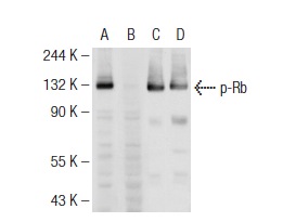 Western blot analysis of Rb phosphorylation in untreated (A,C) and lambda protein phosphatase treated (B,D) MOLT-4 whole cell lysates. Antibodies tested include p-Rb (78.T821/826): sc-135776 (A,B) and Rb (M-153): sc-7905 (C,D).