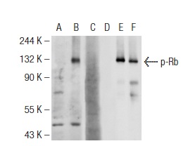 Western blot analysis of Rb phosphorylation in non-transfected: sc-117752 (A,D), untreated human Rb transfected: sc-114014 (B,E) and lambda protein phosphatase treated human Rb transfected: sc-114014 (C,F) 293T whole cell lysates. Antibodies tested include p-Rb (83.T821/826): sc-135777 (A,B,C) and Rb (M-153): sc-7905 (D,E,F).