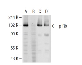 Western blot analysis of Rb phosphorylation in untreated (A,C) and lambda protein phosphatase treated (B,D) MOLT-4 whole cell lysates. Antibodies tested include p-Rb (83.T821/826): sc-135774 (A,B) and Rb (M-153): sc-7905 (C,D).