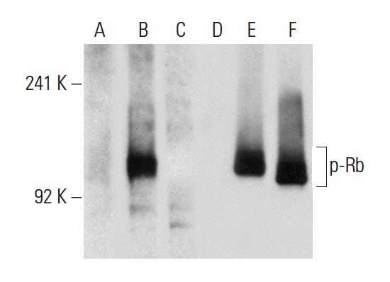 Western blot analysis of Rb phosphorylation in non-transfected: sc-117752 (A,D), untreated human Rb transfected: sc-114014 (B,E) and lambda protein phosphatase (sc-200312A) treated human Rb transfected: sc-114014 (C,F) 293T whole cell lysates. Antibodies tested include p-Rb (E-10): sc-271930 (A,B,C) and Rb (M-153): sc-7905 (D,E,F).