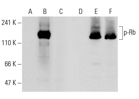 Western blot analysis of Rb phosphorylation in non-transfected: sc-117752 (A,D), untreated human Rb transfected: sc-114014 (B,E) and lambda protein phosphatase (sc-200312A) treated human Rb transfected: sc-114014 (C,F) 293T whole cell lysates. Antibodies tested include p-Rb (Thr 356)-R: sc-16837-R (A,B,C) and Rb (M-153): sc-7905 (D,E,F).