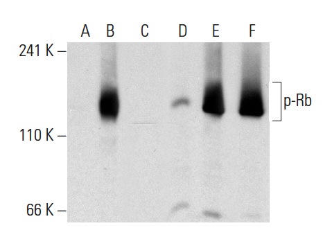 Western blot analysis of Rb phosphorylation in non-transfected: sc-117752 (A,D), untreated human Rb transfected: sc-114014 (B,E) and lambda protein phosphatase (sc-200312A) treated human Rb transfected: sc-114014 (C,F) 293T whole cell lysates. Antibodies tested include p-Rb (Thr 356)-R: sc-16837-R (A,B,C) and Rb (M-153): sc-7905 (D,E,F).