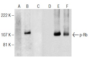 Western blot analysis of Rb phosphorylation in non-transfected: sc-117752 (A,D), untreated human Rb transfected: sc-114014 (B,E) and lambda protein phosphatase (sc-200312A) treated human Rb transfected: sc-114014 (C,F) 293T whole cell lysates. Antibodies tested include p-Rb (A-3): sc-377516 (A,B,C) and Rb (M-153): sc-7905 (D,E,F).