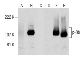 Western blot analysis of Rb phosphorylation in non-transfected: sc-117752 (A,D), untreated human Rb transfected: sc-114014 (B,E) and lambda protein phosphatase (sc-200312A) treated human Rb transfected: sc-114014 (C,F) 293T whole cell lysates. Antibodies tested include p-Rb (C-3): sc-377524 (A,B,C) and Rb (M-153): sc-7905 (D,E,F).