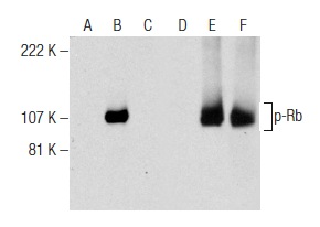 Western blot analysis of Rb phosphorylation in non-transfected: sc-117752 (A,D), untreated human Rb transfected: sc-114014 (B,E) and lambda protein phosphatase (sc-200312A) treated human Rb transfected: sc-114014 (C,F) 293T whole cell lysates. Antibodies tested include p-Rb (B-7): sc-377527 (A,B,C) and Rb (M-153): sc-7905 (D,E,F).
