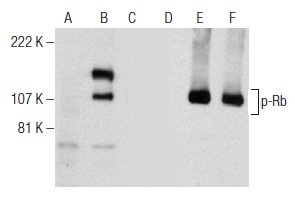 Western blot analysis of Rb phosphorylation in non-transfected: sc-117752 (A,D), untreated human Rb transfected: sc-114014 (B,E) and lambda protein phosphatase (sc-200312A) treated human Rb transfected: sc-114014 (C,F) 293T whole cell lysates. Antibodies tested include p-Rb (A-5): sc-377528 (A,B,C) and Rb (M-153): sc-7905 (D,E,F).