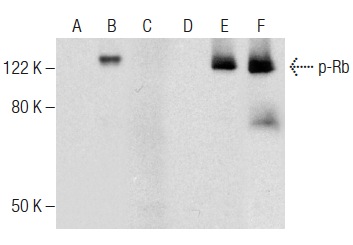 Western blot analysis of Rb phosphorylation in non-transfected: sc-117752 (A,D), untreated human Rb transfected: sc-114014 (B,E) and lambda protein phosphatase (sc-200312A) treated human Rb transfected: sc-114014 (C,F) 293T whole cell lysates. Antibodies tested include p-Rb (F-2): sc-377539 (A,B,C) and Rb (M-153): sc-7905 (D,E,F).