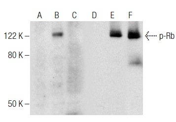 Western blot analysis of Rb phosphorylation in non-transfected: sc-117752 (A,D), untreated human Rb transfected: sc-114014 (B,E) and lambda protein phosphatase (sc-200312A) treated human Rb transfected: sc-114014 (C,F) 293T whole cell lysates. Antibodies tested include p-Rb (F-4): sc-377540 (A,B,C) and Rb (M-153): sc-7905 (D,E,F).