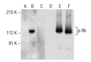 Western blot analysis of Rb phosphorylation in non-transfected: sc-117752 (A,D), untreated human Rb transfected: sc-114014 (B,E) and lambda protein phosphatase (sc-200312A) treated human Rb transfected: sc-114014 (C,F) 293T whole cell lysates. Antibodies tested include p-Rb (B-8): sc-377541 (A,B,C) and Rb (M-153): sc-7905 (D,E,F).