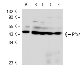 Rfp2 (N-15): sc-69606. Western blot analysis of Rfp2 expression in HEK293 (A), IMR-32 (B) and SK-N-MC (C) whole cell lysates and mouse embryo (D) and mouse lymph node (E) tissue extracts.