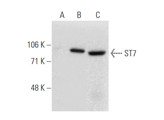 ST7 (P-12): sc-160851. Western blot analysis of ST7 expression in non-transfected 293T: sc-117752 (A), mouse ST7 transfected 293T: sc-123799 (B) and SW480 (C) whole cell lysates.