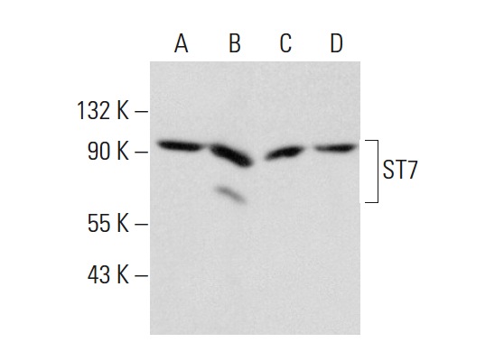 ST7 (P-12): sc-160851. Western blot analysis of ST7 expression in Hep G2 (A), MIA PaCa-2 (B) and c4 (C) whole cell lysates and mouse pancreas tissue extract (D).