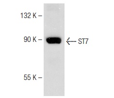 ST7 (P-12): sc-160851. Western blot analysis of ST7 expression in SK-MEL-28 whole cell lysate.