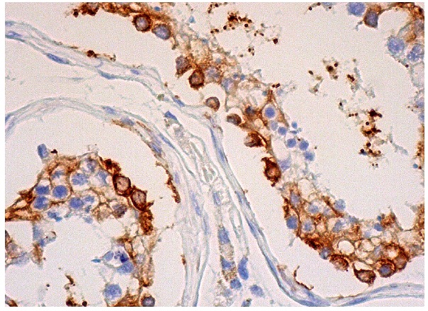 BAP31 (C-15): sc-18579. Immunoperoxidase staining of formalin fixed, paraffin-embedded human testis tissue showing cytoplasmic staining of cells in seminiferous ducts.