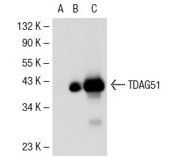 TDAG51 (RN-6E2): sc-23866. Western blot analysis of TDAG51 expression in non-transfected 293T: sc-117752 (A), mouse TDAG51 transfected 293T: sc-123964 (B) and Hep G2 (C) whole cell lysates.