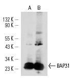 BAP31 (H-90): sc-48766. Western blot analysis of BAP31 expression in BJAB (A) and HL-60 (B) whole cell lysates.