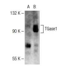 TGase1 (E-6): sc-166467. Western blot analysis of TGase1 expression in non-transfected: sc-117752 (A) and human TGase1 transfected: sc-171609 (B) 293T whole cell lysates.