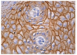 TGase1 (E-6): sc-166467. Immunoperoxidase staining of formalin fixed, paraffin-embedded human oral mucosa tissue showing membrane staining of squamous epithelial cells.