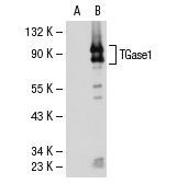 TGase1 (H-87): sc-25786. Western blot analysis of TGase1 expression in non-transfected: sc-117752 (A) and human TGase1 transfected: sc-113816 (B) 293T whole cell lysates.