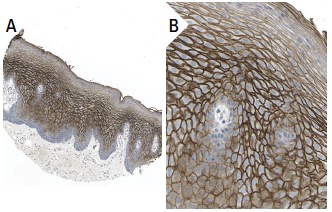TGase1 (H-87): sc-25786. Immunoperoxidase staining of formalin fixed, paraffin-embedded human oral mucosa tissue showing membrane staining of squamous epithelial cells (low and high magnification). Kindly provided by The Swedish Human Protein Atlas (HPA) program.
