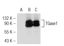 TGase1 (H-87): sc-25786. Western blot analysis of TGase1 expression in non-transfected 293T: sc-117752 (A), mouse TGase1 transfected 293T: sc-124015 (B) and Caki-1 (C) whole cell lysates.