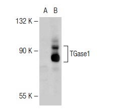 TGase1 (H-87): sc-25786. Western blot analysis of TGase1 expression in non-transfected: sc-117752 (A) and human TGase1 transfected: sc-171609 (B) 293T whole cell lysates.